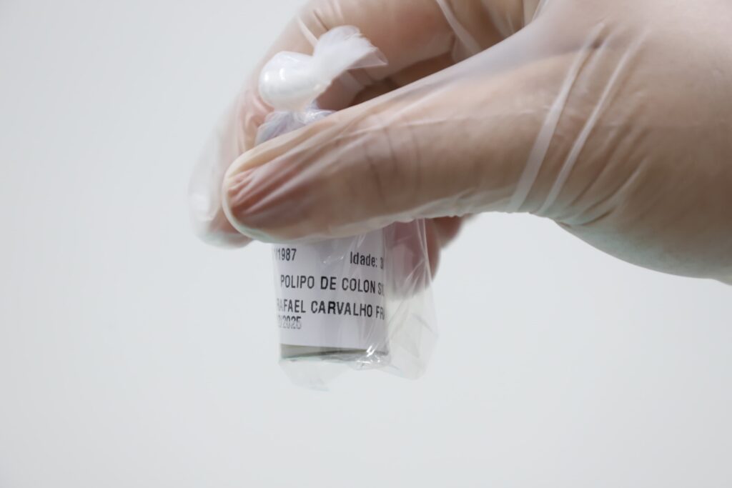 Saúde Estadual promove mutirão de prevenção ao câncer de intestino